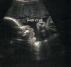 babya.jpg